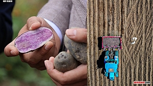 Obezite, kanser düşmanı mor patates